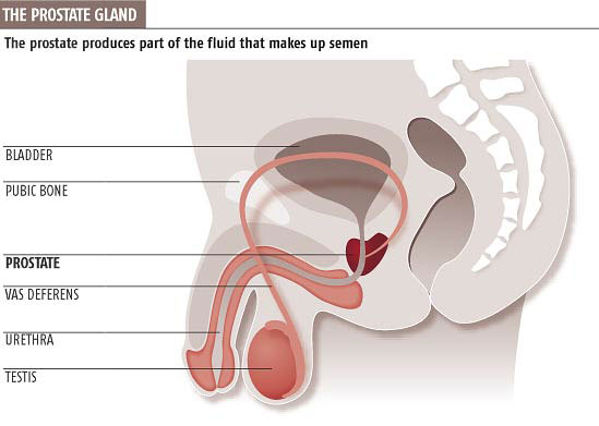 Prostate Cancer - Urological Health Topics - Tracy and Manteca